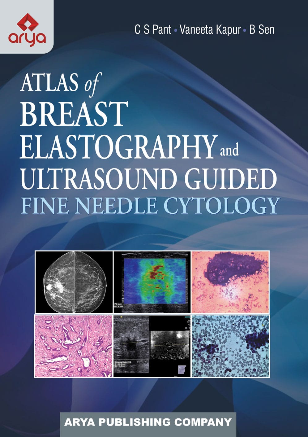 Atlas of Breast Elastography and Ultrasound Guided Fine Needle Cytology (Hardbound)