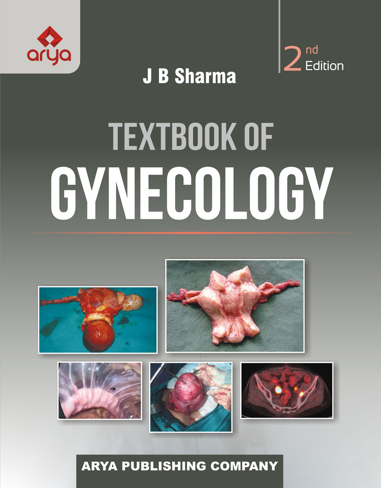 Textbook of Gynecology