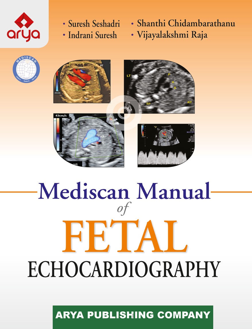 Mediscan Manual of Fetal Echocardiography